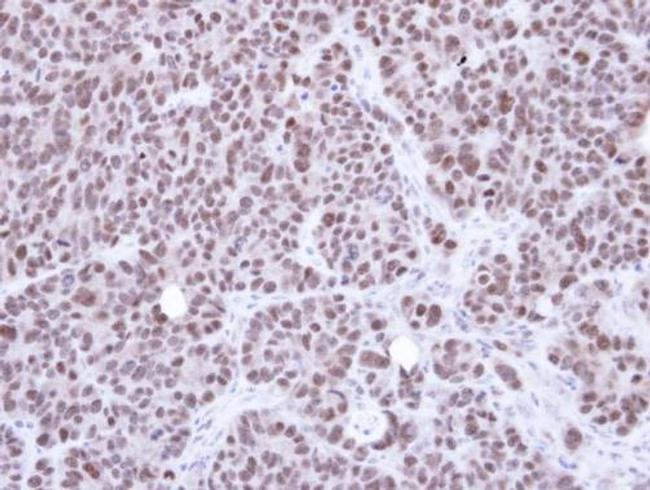 NSMCE1 Antibody in Immunohistochemistry (Paraffin) (IHC (P))