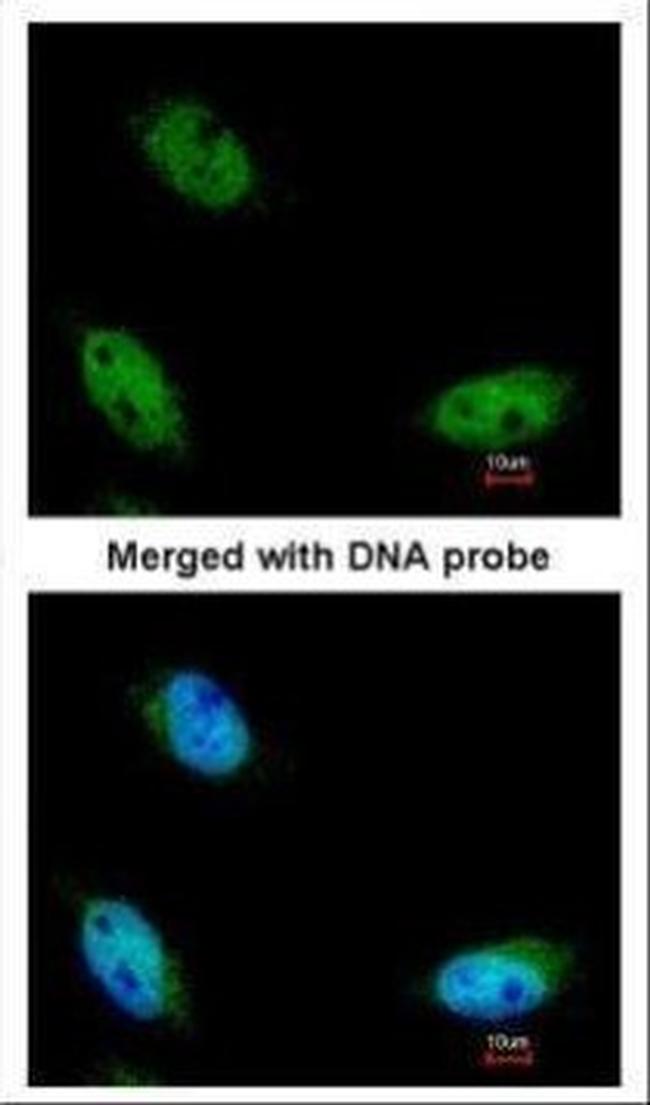 NSUN6 Antibody in Immunocytochemistry (ICC/IF)