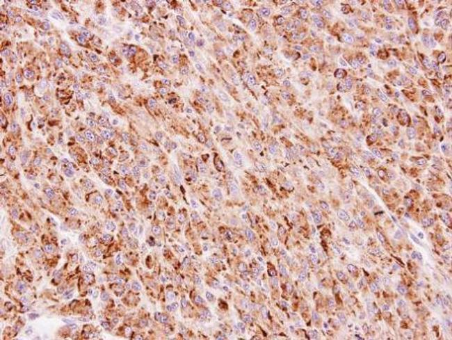 TTC30A Antibody in Immunohistochemistry (Paraffin) (IHC (P))