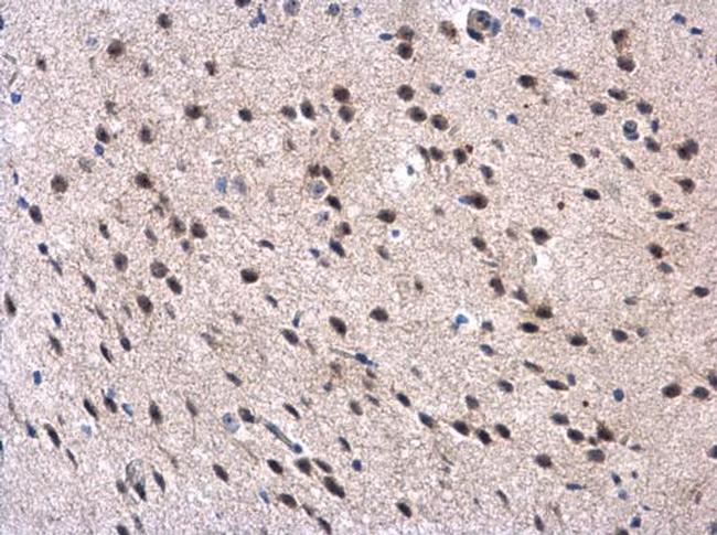 MPP3 Antibody in Immunohistochemistry (Paraffin) (IHC (P))