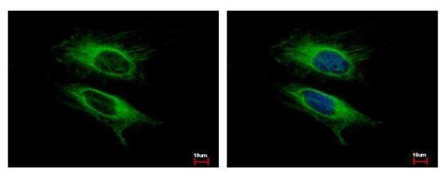 VPS11 Antibody in Immunocytochemistry (ICC/IF)