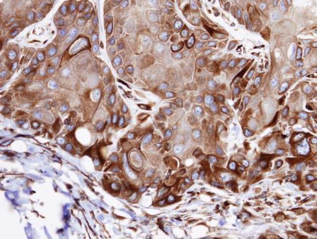 VPS16 Antibody in Immunohistochemistry (Paraffin) (IHC (P))