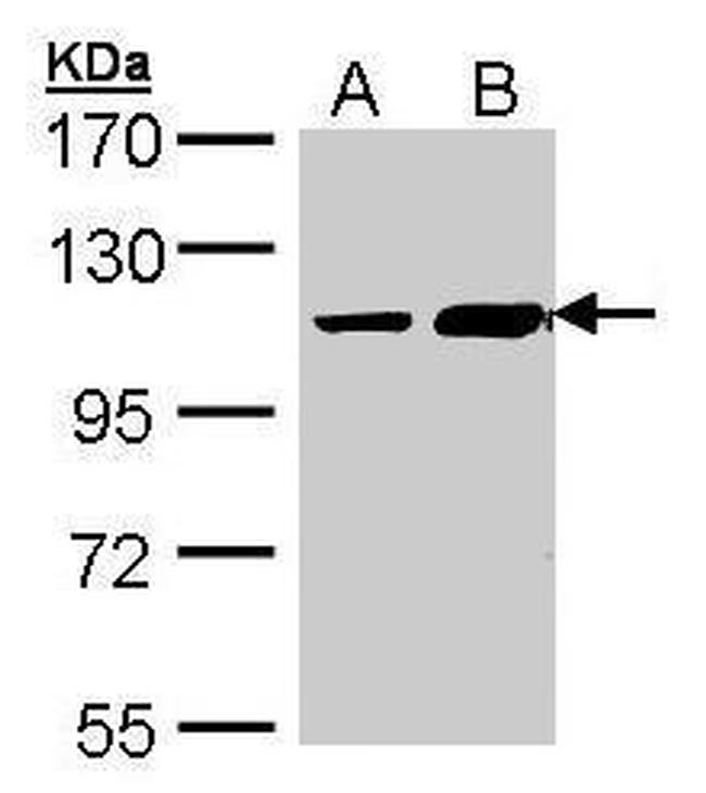 TRAK2 Antibody in Western Blot (WB)