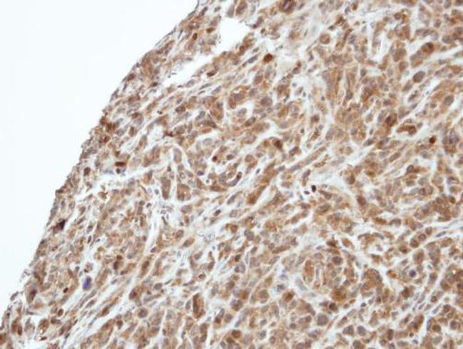 PI3K p55 gamma Antibody in Immunohistochemistry (Paraffin) (IHC (P))