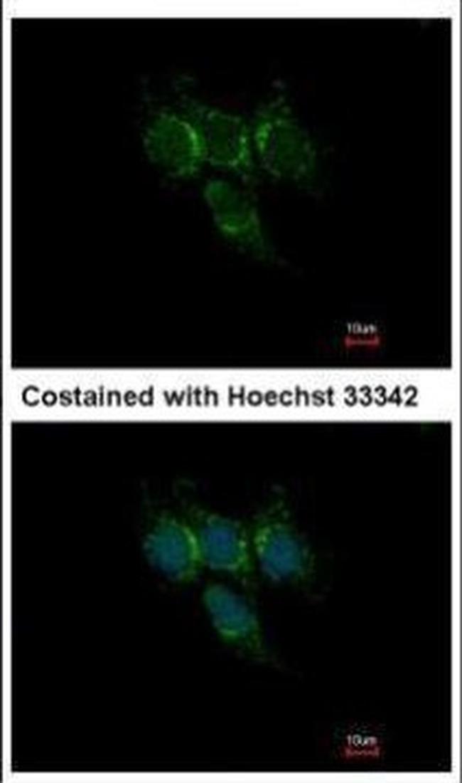 GSTA1 Antibody in Immunocytochemistry (ICC/IF)