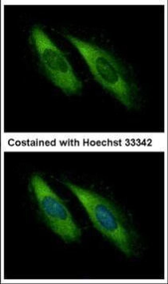 Munc13-4 Antibody in Immunocytochemistry (ICC/IF)