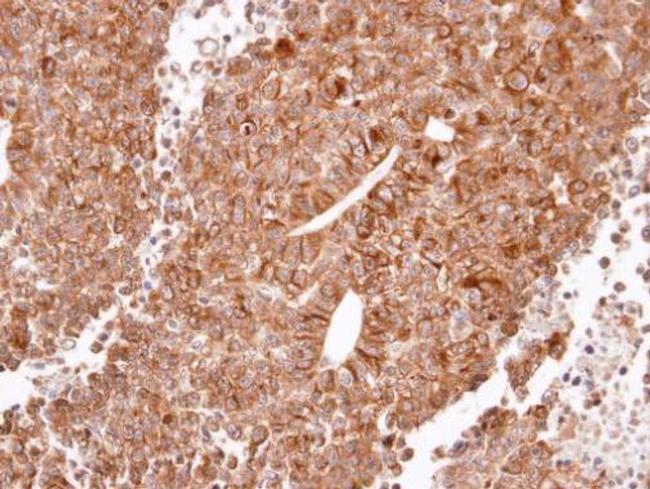 HRH2 Antibody in Immunohistochemistry (Paraffin) (IHC (P))