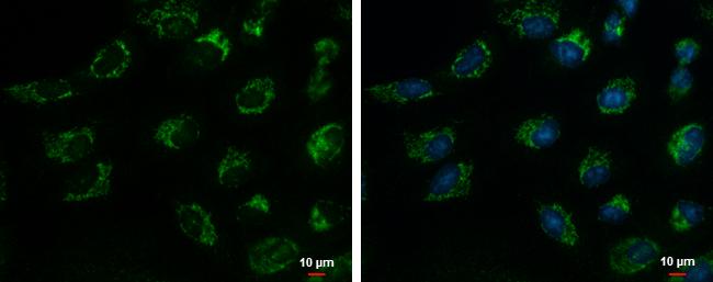 TIM17 Antibody in Immunocytochemistry (ICC/IF)