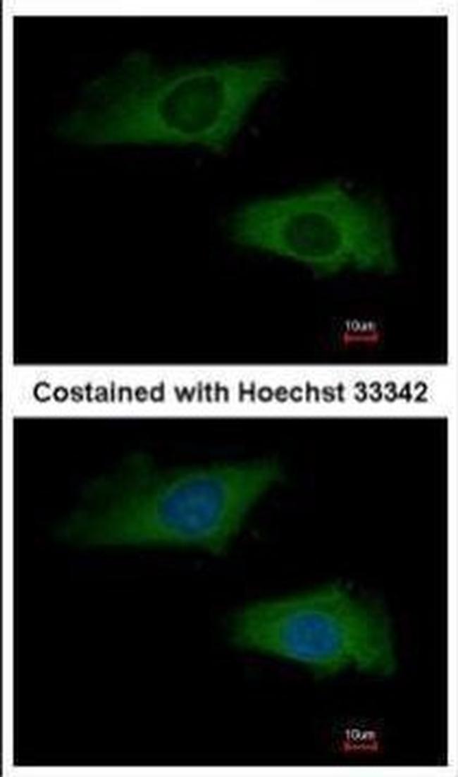 Interferon alpha-2 Antibody in Immunocytochemistry (ICC/IF)