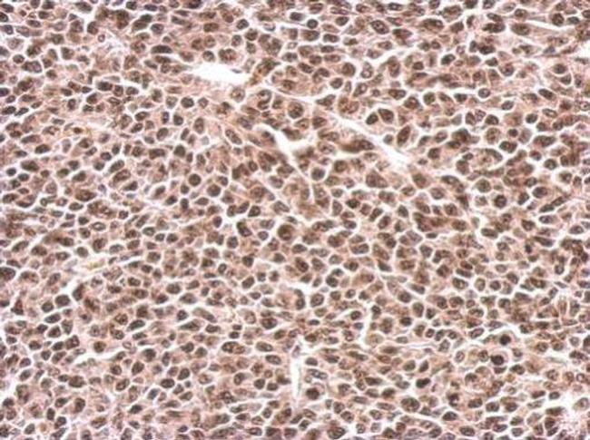 PFKFB3 Antibody in Immunohistochemistry (Paraffin) (IHC (P))