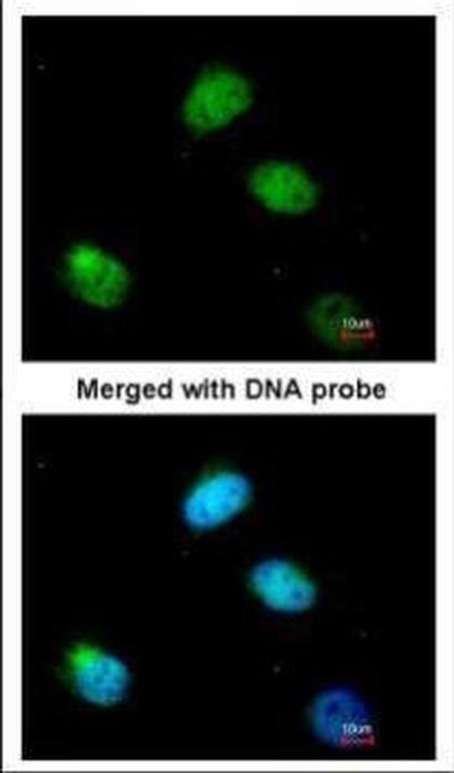 PCBP2 Antibody in Immunocytochemistry (ICC/IF)