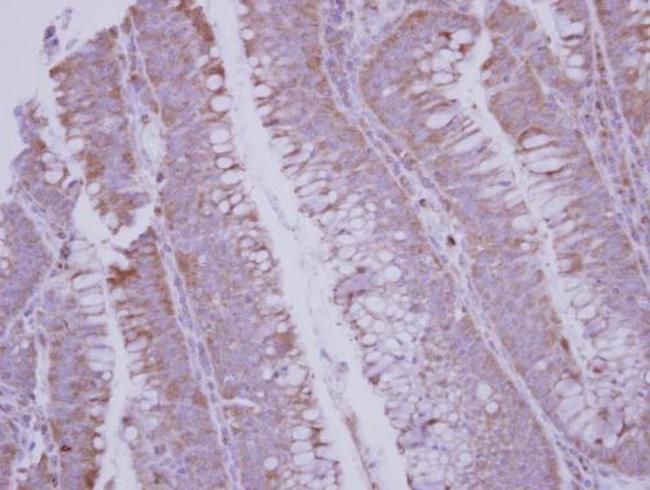 BMP-10 Antibody in Immunohistochemistry (Paraffin) (IHC (P))