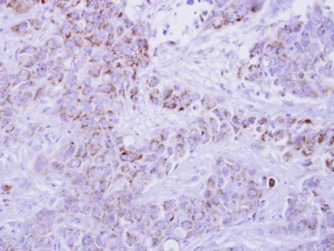 CCL1 Antibody in Immunohistochemistry (Paraffin) (IHC (P))