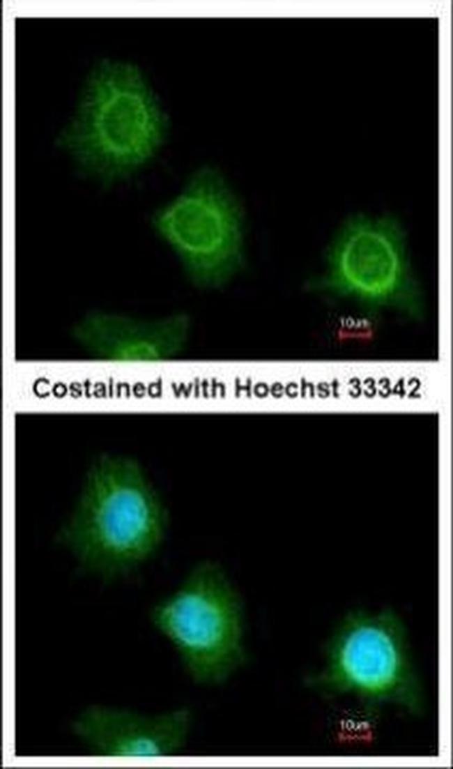 PF4V1 Antibody in Immunocytochemistry (ICC/IF)