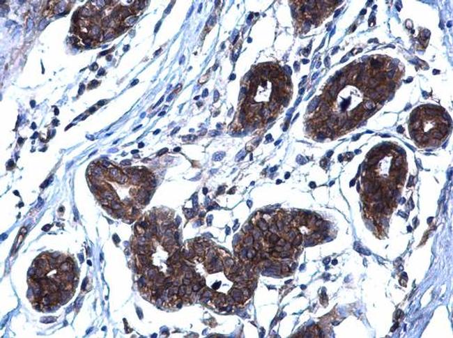 CD254 (RANK Ligand) Antibody in Immunohistochemistry (Paraffin) (IHC (P))