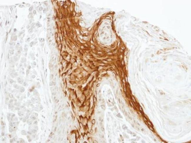 RAMP2 Antibody in Immunohistochemistry (Paraffin) (IHC (P))