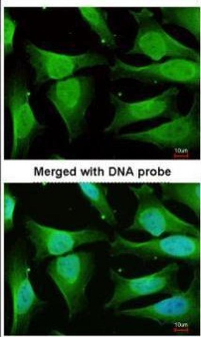 CAMK1D Antibody in Immunocytochemistry (ICC/IF)