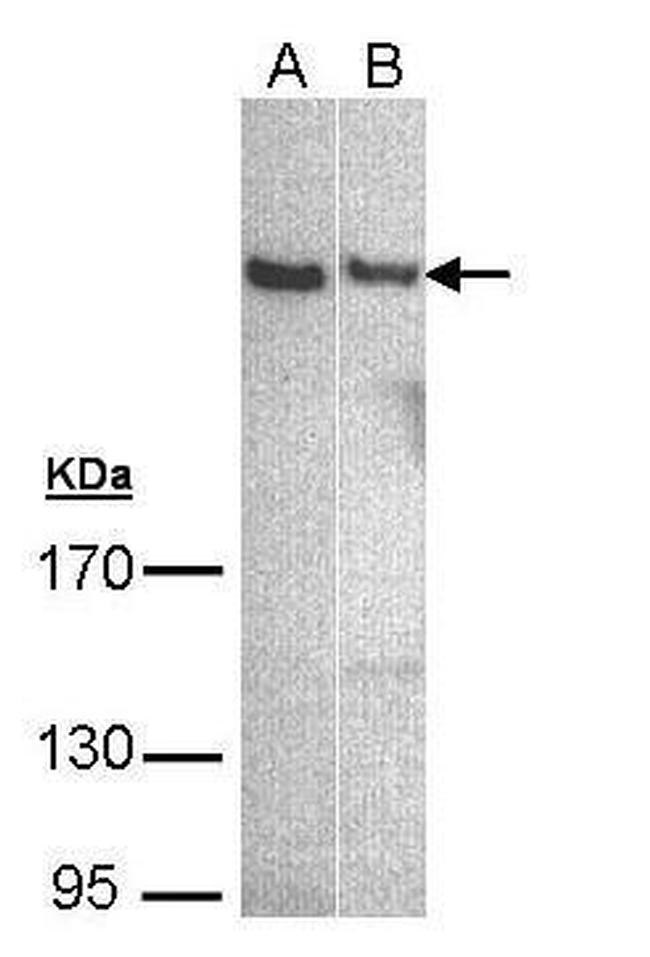 PLCH1 Isoform B Antibody in Western Blot (WB)