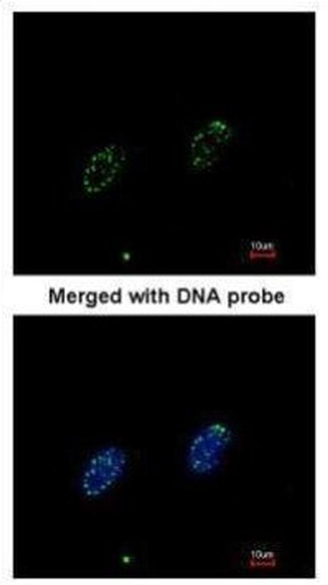 RPA70 Antibody in Immunocytochemistry (ICC/IF)