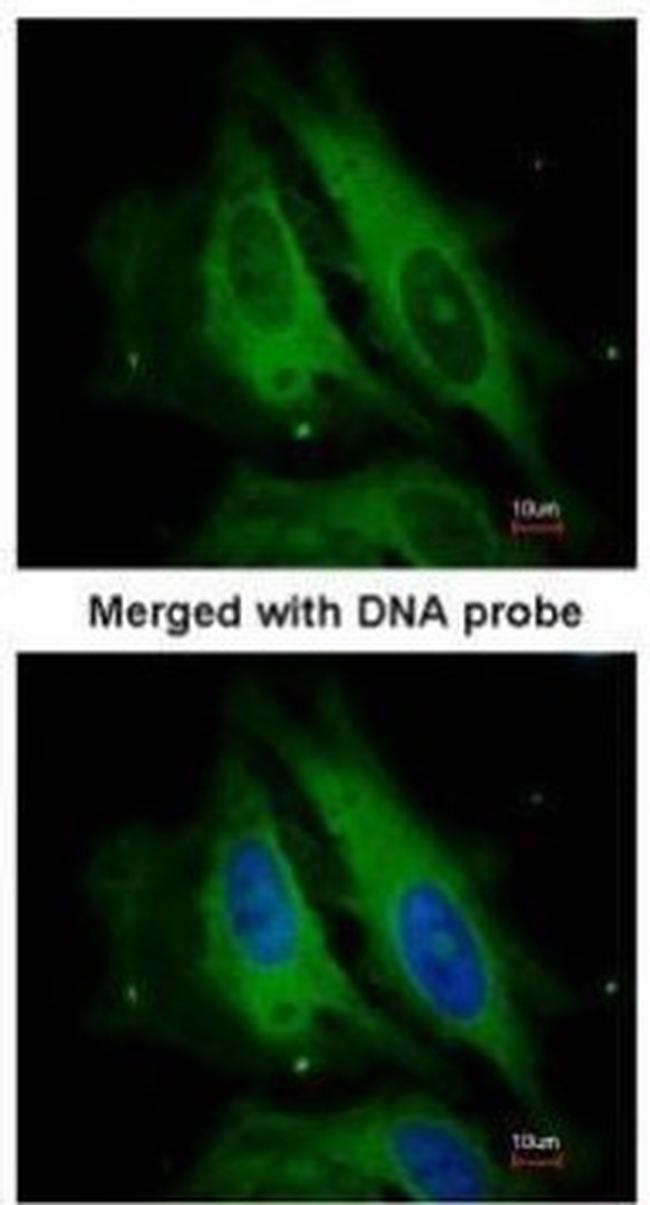 NOD1 Antibody in Immunocytochemistry (ICC/IF)