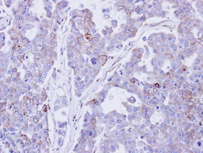 Desmocollin 2 Antibody in Immunohistochemistry (Paraffin) (IHC (P))