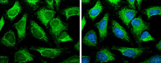 SLC25A13 Antibody in Immunocytochemistry (ICC/IF)