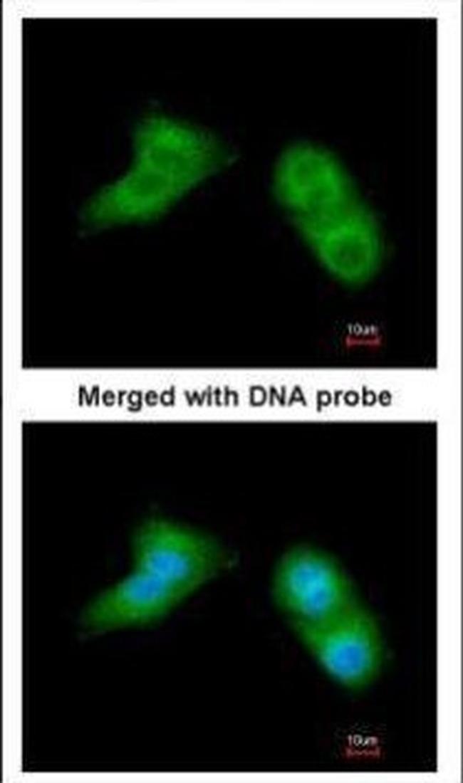 UBE2G2 Antibody in Immunocytochemistry (ICC/IF)