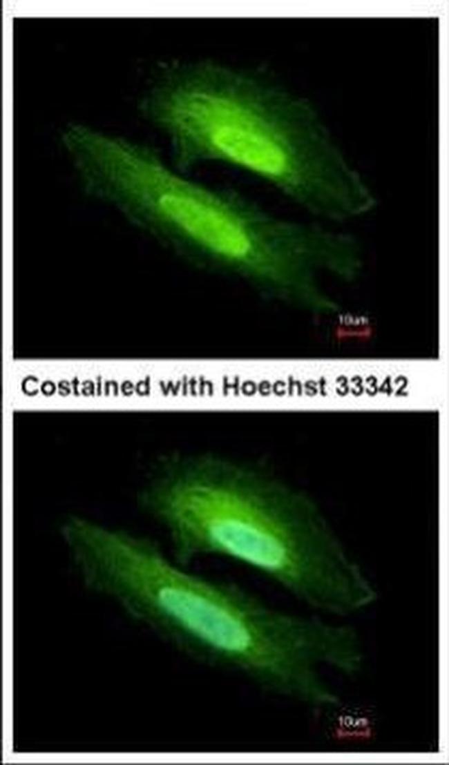 PDE6D Antibody in Immunocytochemistry (ICC/IF)