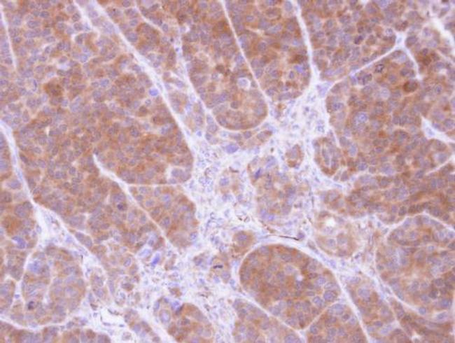 TPM2 Antibody in Immunohistochemistry (Paraffin) (IHC (P))