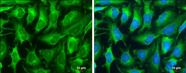 DNase I Antibody in Immunocytochemistry (ICC/IF)