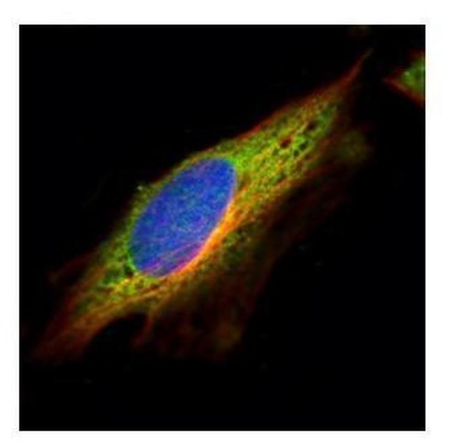 EPHX1 Antibody in Immunocytochemistry (ICC/IF)