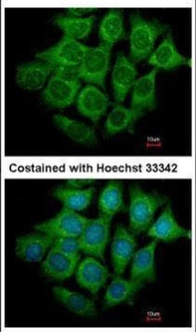 UBE4B Antibody in Immunocytochemistry (ICC/IF)