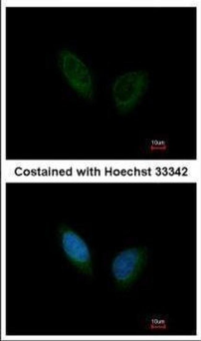 PHKA1 Antibody in Immunocytochemistry (ICC/IF)