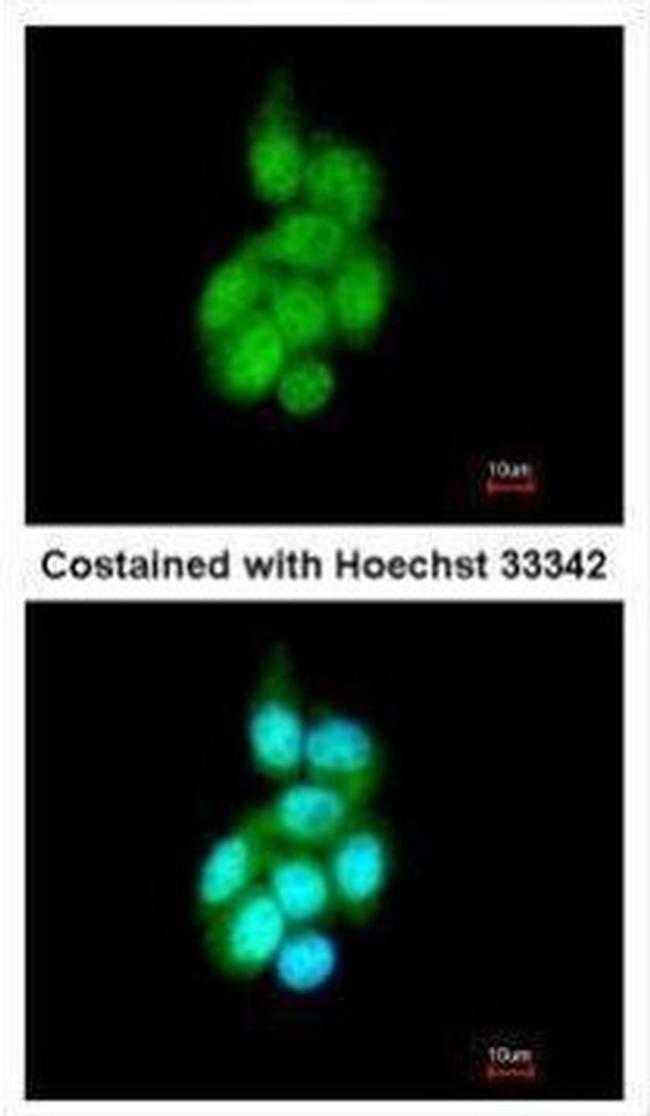 BAIAP2L1 Antibody in Immunocytochemistry (ICC/IF)