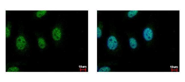 Cdc45L Antibody in Immunocytochemistry (ICC/IF)