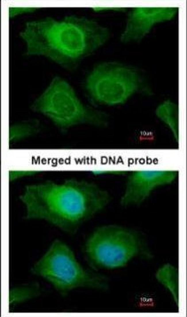 AKR1B10 Antibody in Immunocytochemistry (ICC/IF)