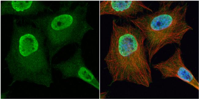 PGAM2 Antibody in Immunocytochemistry (ICC/IF)