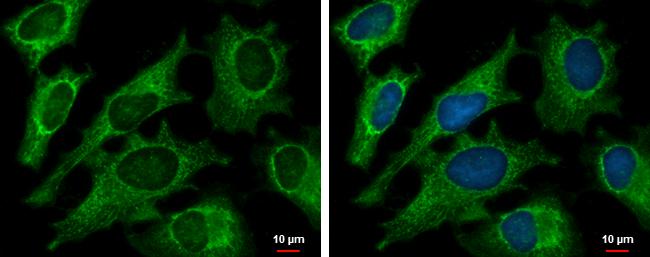 DECR1 Antibody in Immunocytochemistry (ICC/IF)