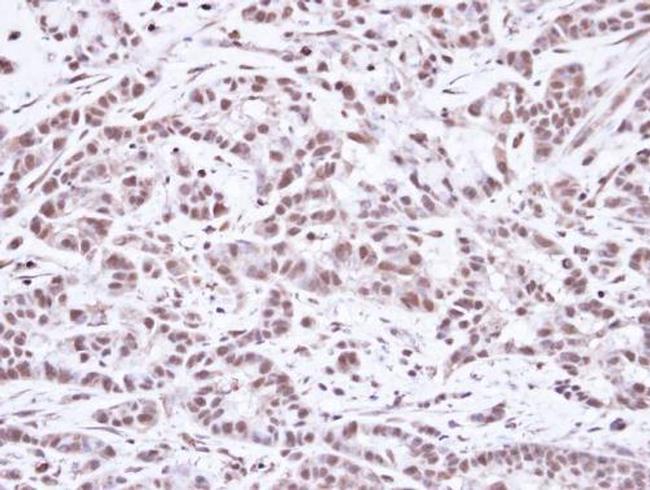 SMC1 Antibody in Immunohistochemistry (Paraffin) (IHC (P))