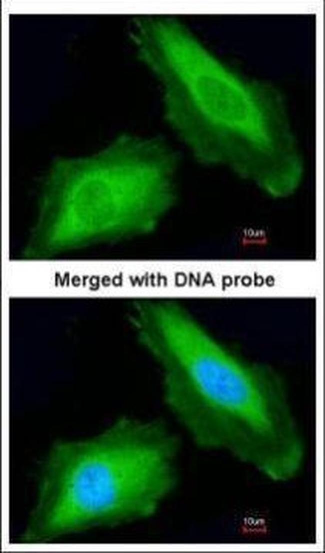 DDX3Y Antibody in Immunocytochemistry (ICC/IF)