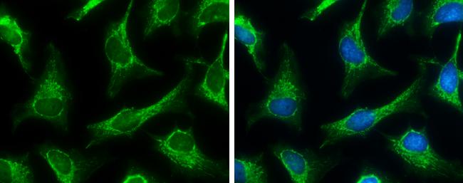 SUCLA2 Antibody in Immunocytochemistry (ICC/IF)