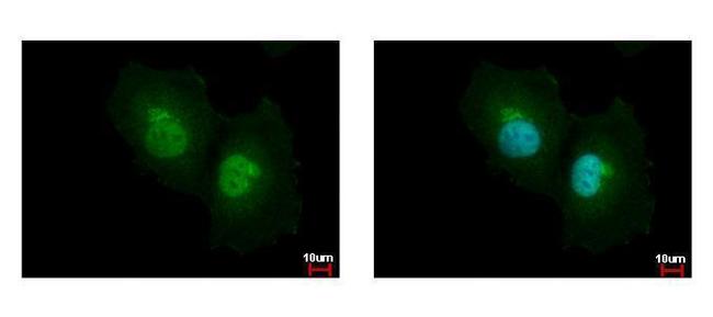 ASL Antibody in Immunocytochemistry (ICC/IF)