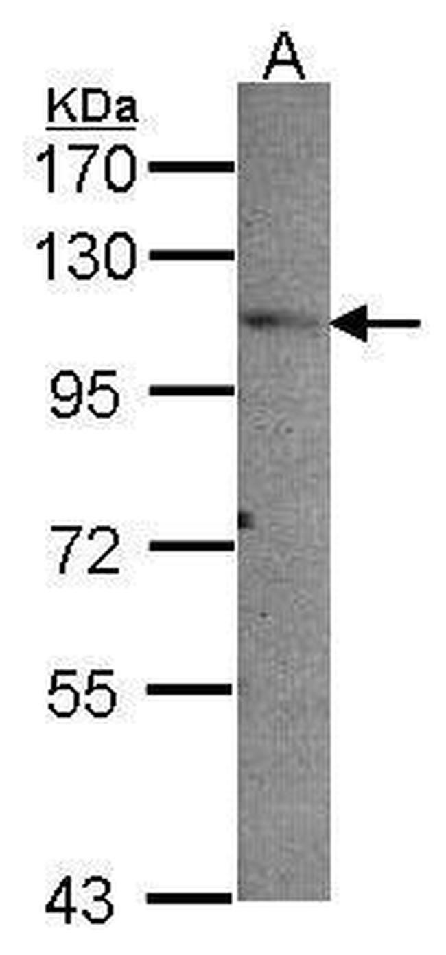 PEX6 Antibody in Western Blot (WB)