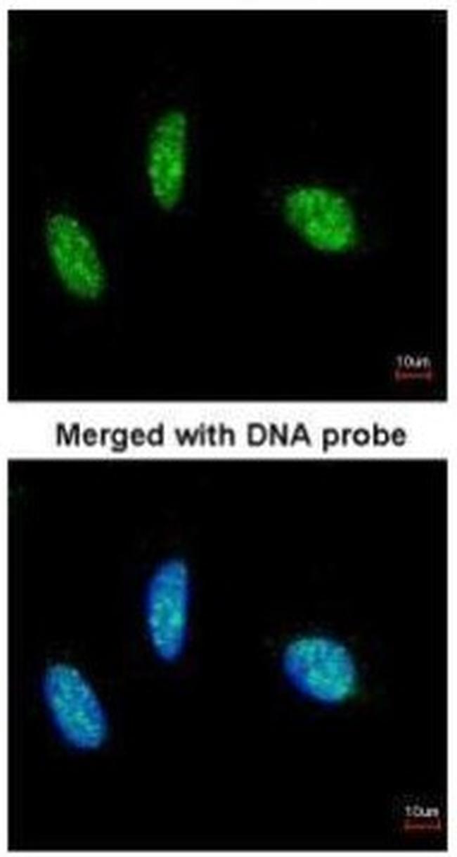 RBM15 Antibody in Immunocytochemistry (ICC/IF)