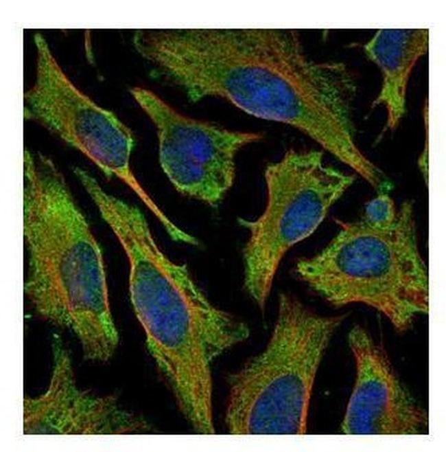 Villin Antibody in Immunocytochemistry (ICC/IF)