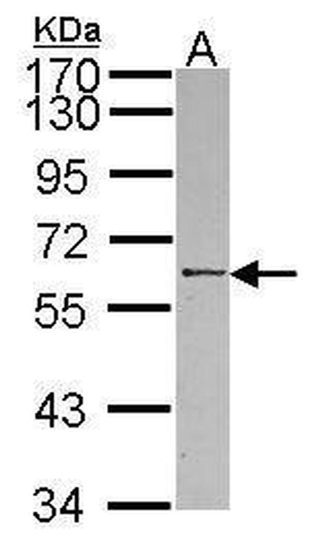 RBMY1A1 Antibody in Western Blot (WB)