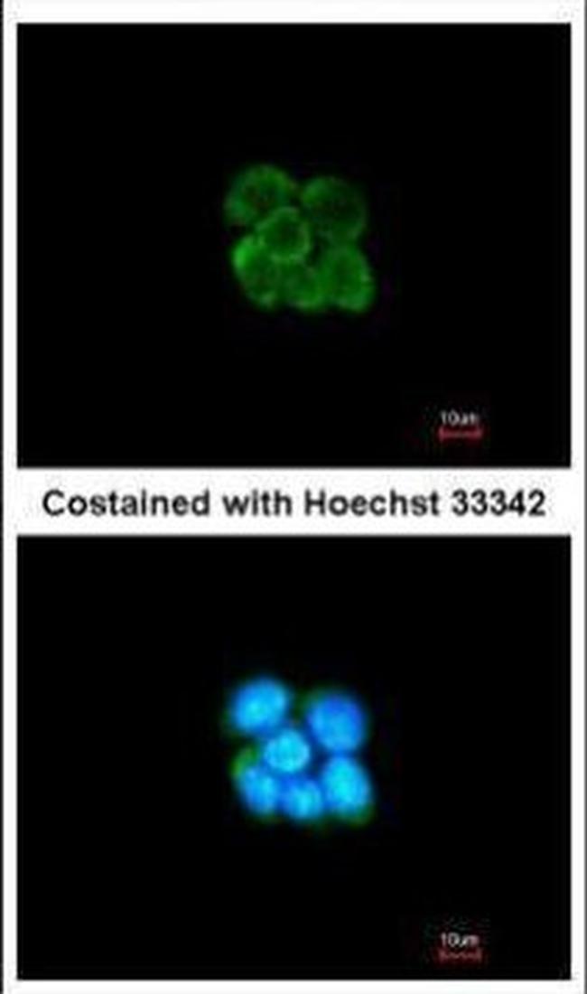 SERPINF2 Antibody in Immunocytochemistry (ICC/IF)