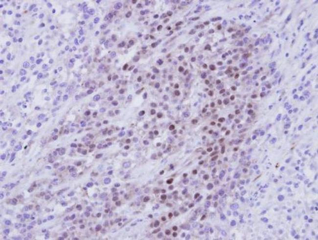 RBMY1A1 Antibody in Immunohistochemistry (Paraffin) (IHC (P))