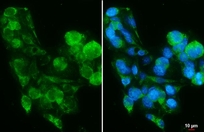 PIGR Antibody in Immunocytochemistry (ICC/IF)