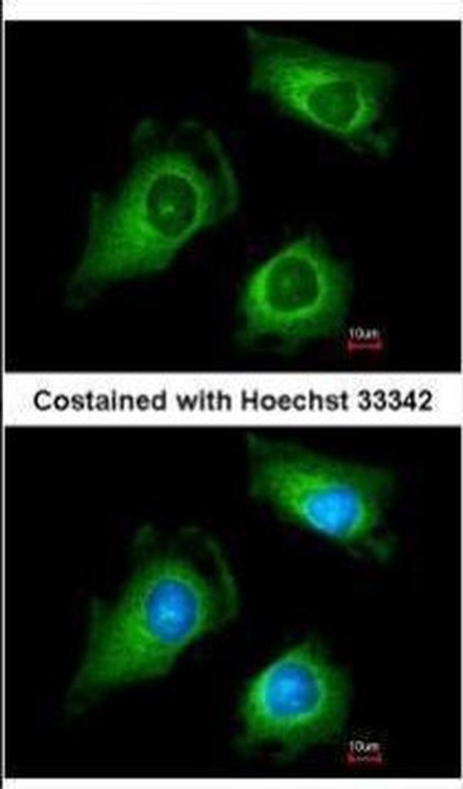 FKTN Antibody in Immunocytochemistry (ICC/IF)